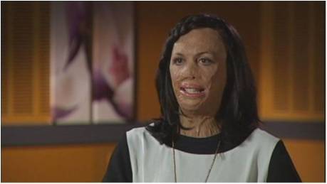 Can-Do-Ability: Turia Pitt Update